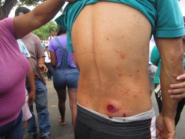 José Guerra fue reprimido en Villa Polígono por manifestar|Correo del Caroní