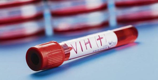 Pacientes de VIH en "alto riesgo" debido a escasez de medicamentos |Foto referencial