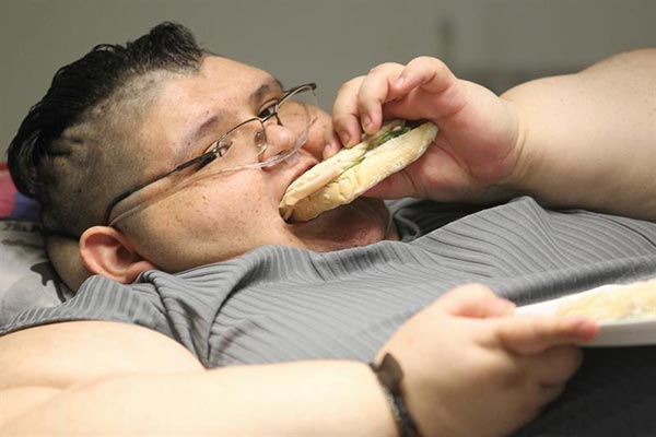 El mexicano Juan Pedro Franco es el hombre más obeso del mundo | Foto: EFE