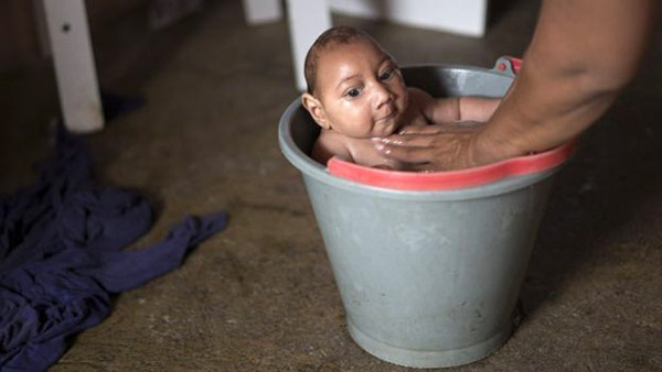 Jose Wesley, el bebé con microcefalia que se convirtió en la cara de la emergencia global por el zika