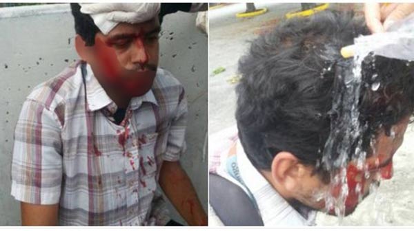Periodista resulta herido por bomba lacrimógena | Foto: Twitter