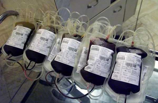 Denuncian negocio del gobierno cubano con la venta de sangre | Foto referencial