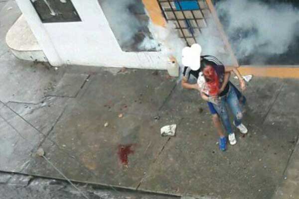 Joven fue herida en la cara con perdigones durante protestas en Táchira | Foto: Twitter