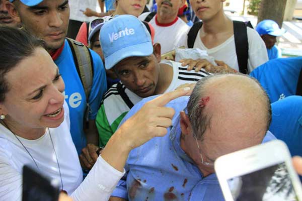 Diputado Omar González Moreno fue herido en la cabeza durante represión en Anzoátegui | Foto: @MariaCorinaYA
