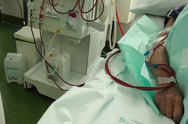 Pacientes renales están en delicadas condición |Foto: El Estímulo