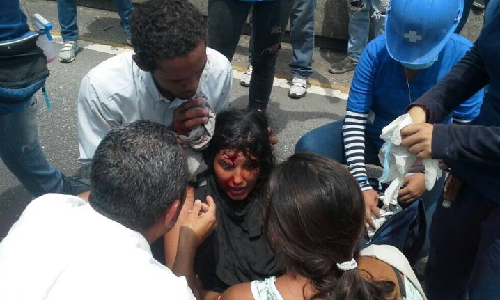 Mujer herida por lacrimógena | Foto: Twitter