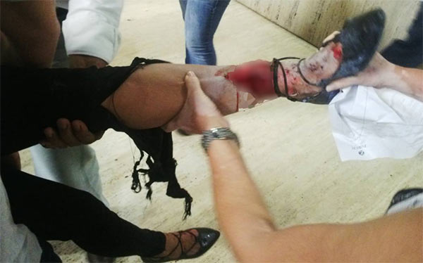 Mujer herida en la pierna | Foto: Twitter