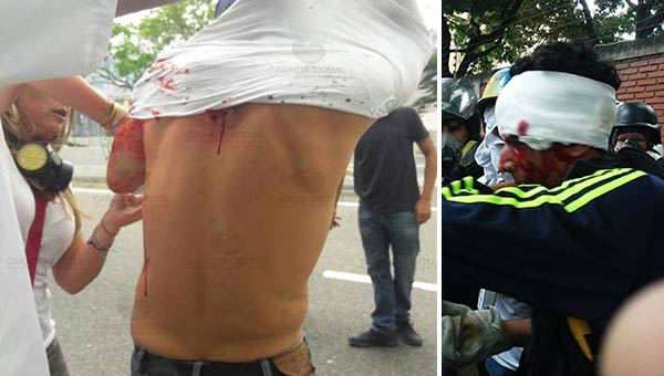 Heridos durante represión en Montalbán | Fotos: Caraota Digital/ El Nacional