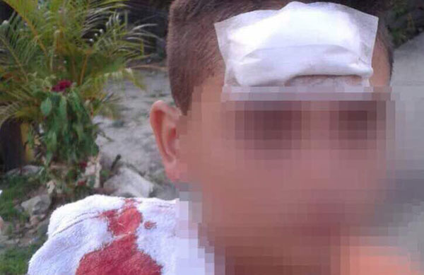 GNB hirió en la cabeza a niño de 11 años durante protesta en Táchira | Foto: @karimveras 