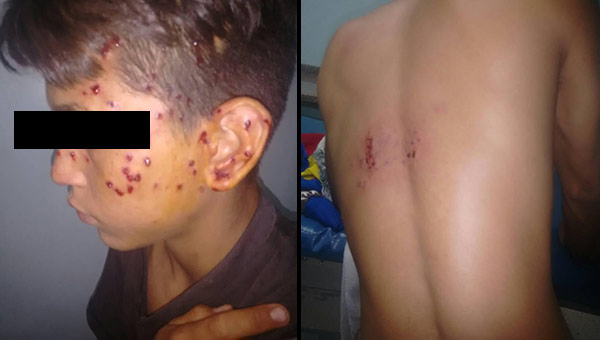 Adolescente de 14 años fue víctima de la represión | Fotos: Twitter