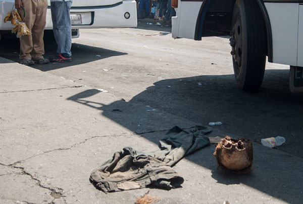Hallan cráneo humano en terminal de Barquisimeto | Foto: El Impulso