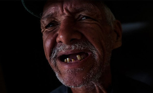 Crisis deja sin dientes a los venezolanos | Foto: El Estímulo