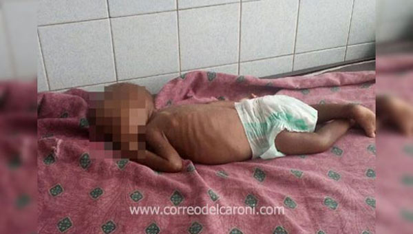 Han muerto 41 niños por desnutrición en San Félix | Foto: Correo del Caroní