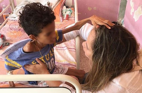 Murió por desnutrición adolescente de 13 años en Portuguesa | Foto cortesía 