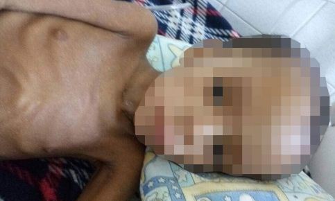 Muere otro niño por desnutrición en Guayana | Foto: Caraota Digital